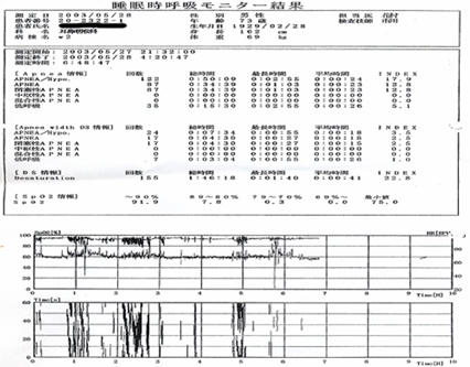 After five weeks of use: The number of breathing pauses during sleep significantly decreased.